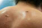 Sweaty back with two small scars