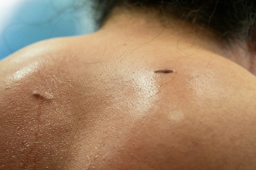 Sweaty back with two small scars